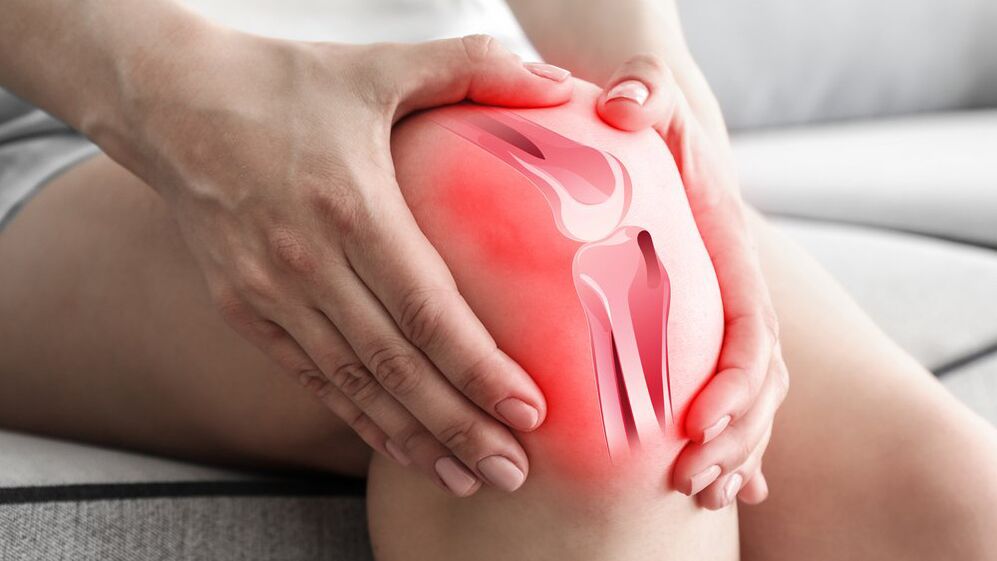Tratamento para dores nas articulações Osteflex