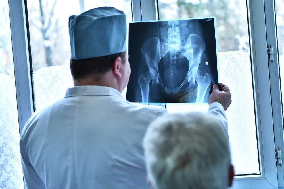 O médico olha a foto de uma articulação do quadril com artrose